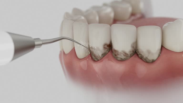 Trusted Tooth Extraction service in Fowlerville, MI - Dentist Open Now